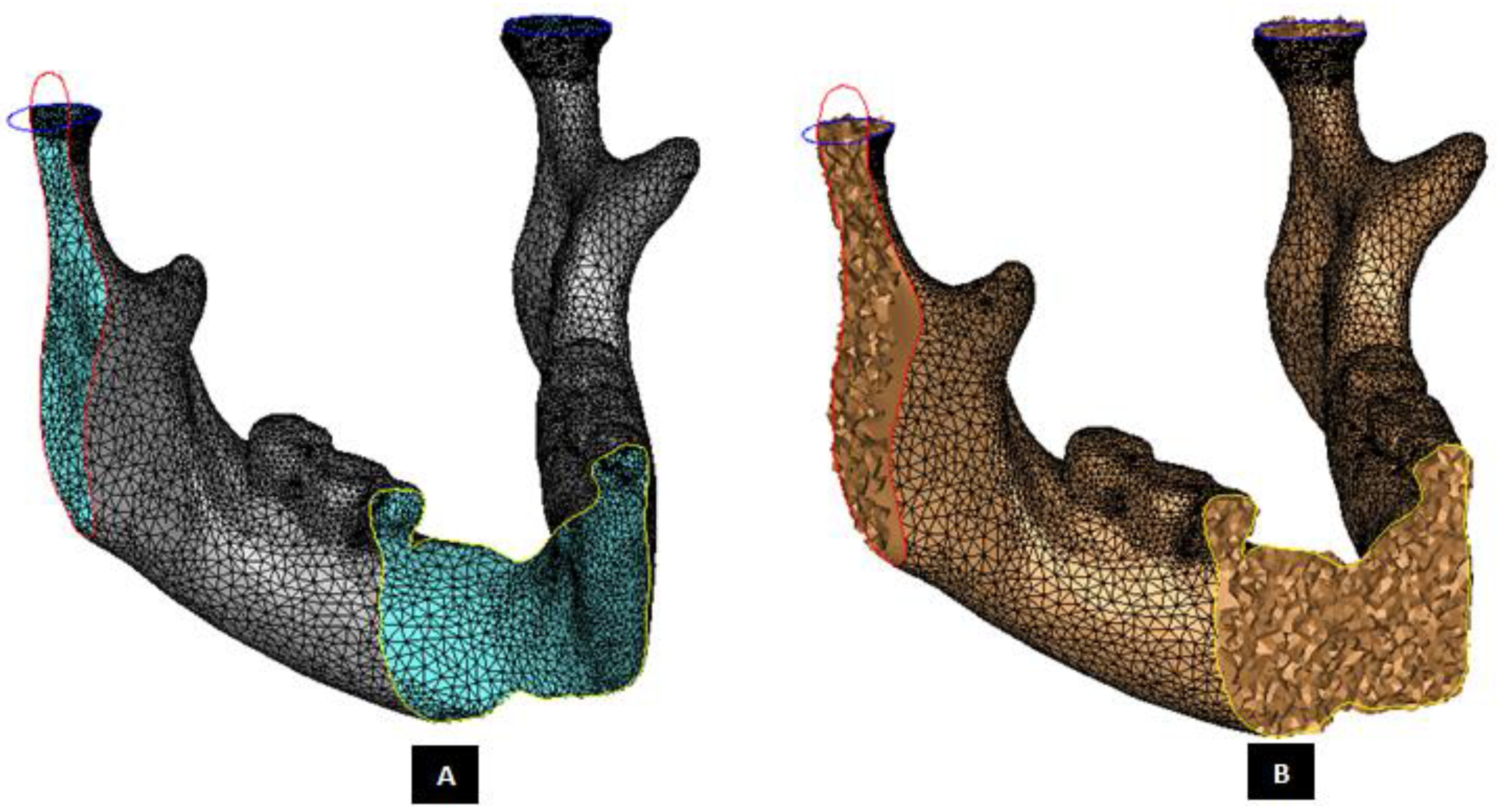 Medical Science Monitor  Biomechanical Behavior of All-on-4 and M-4  Configurations in an Atrophic Maxilla: A 3D Finite Element Method - Article  abstract #929908