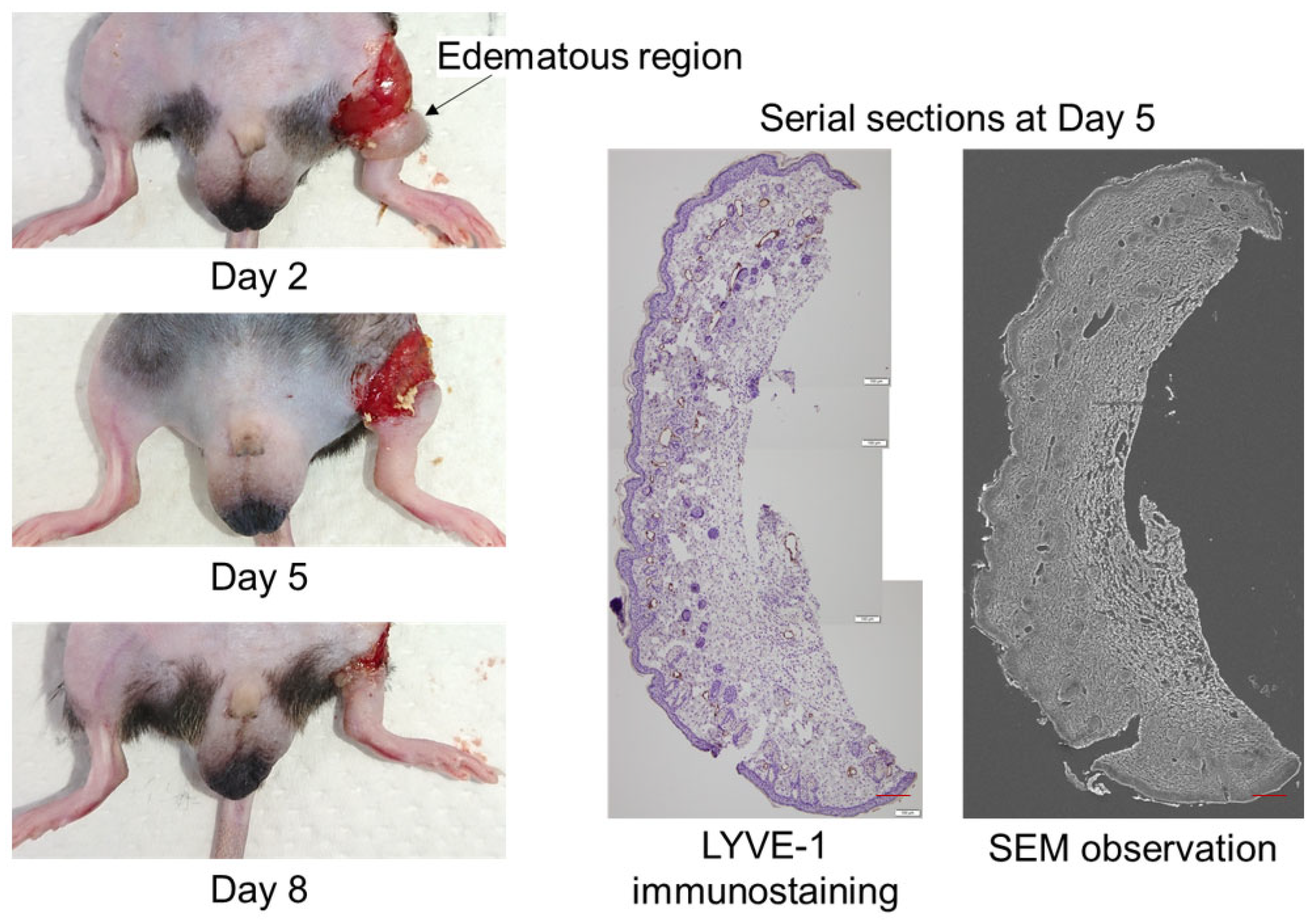 Lymphatics 01 00014 g001