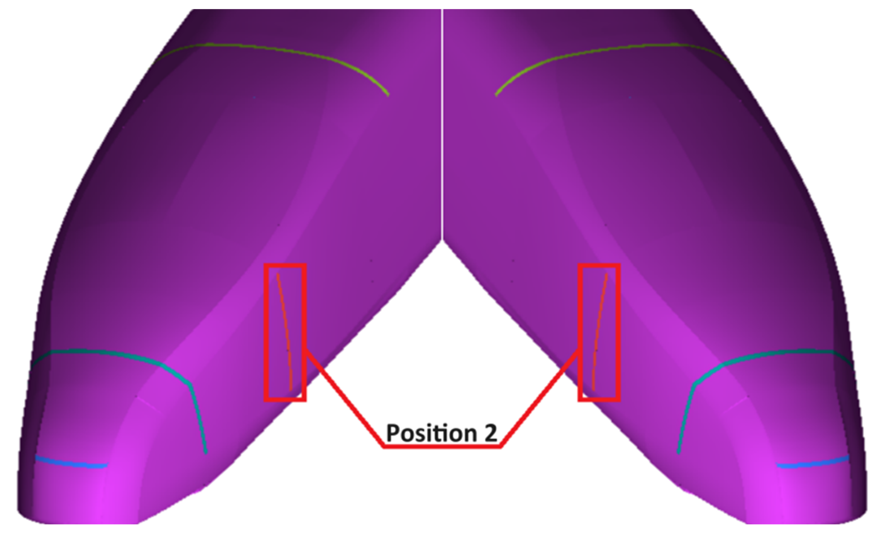 Machines 11 01078 g015