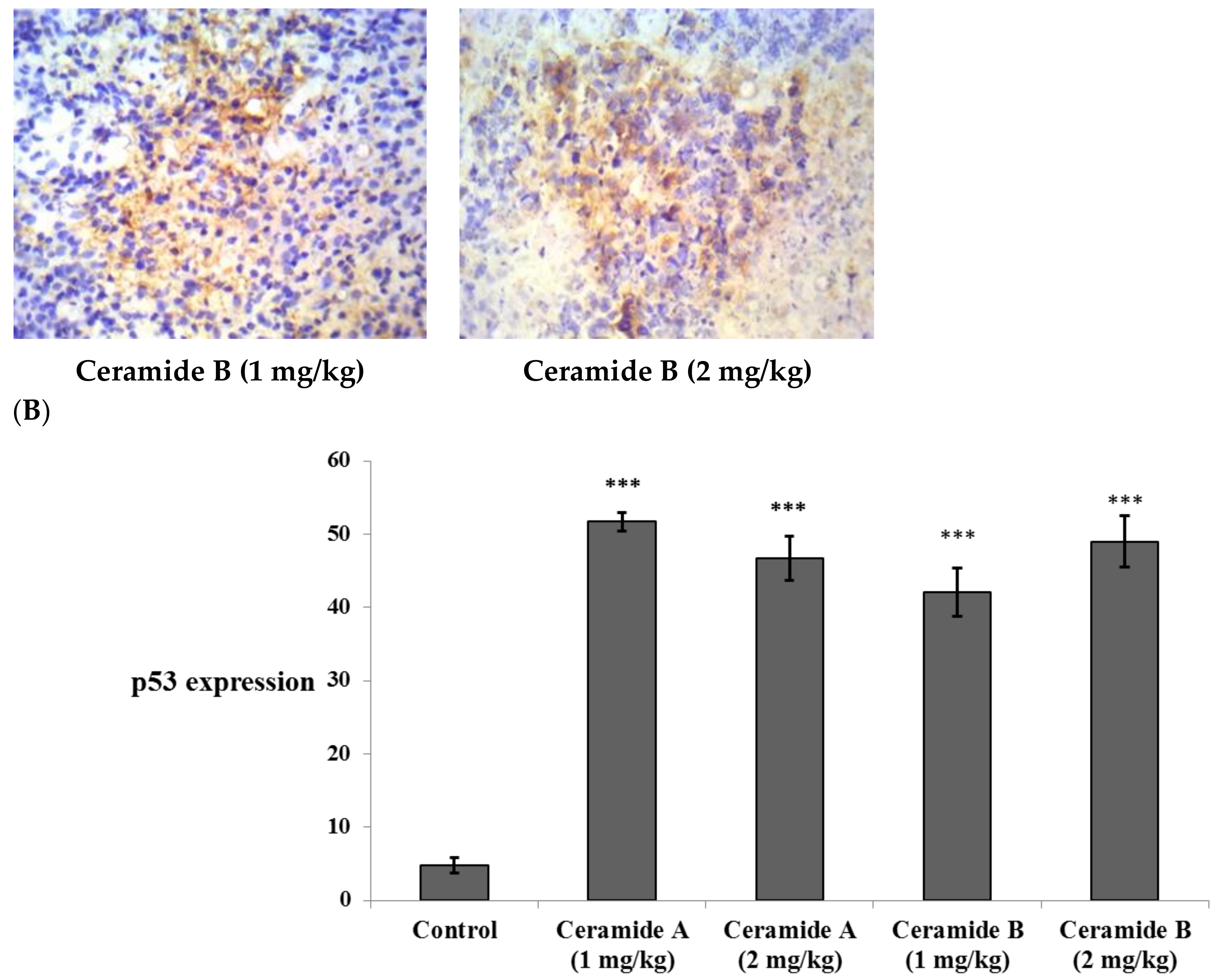 Marine Drugs | Free Full-Text | Anticancer Effects of New Ceramides  Isolated from the Red Sea Red Algae Hypnea musciformis in a Model of  Ehrlich Ascites Carcinoma: LC-HRMS Analysis Profile and Molecular Modeling
