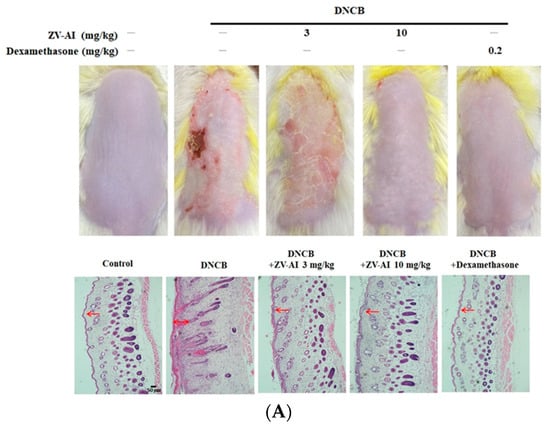 Anti Atopic Dermatitis Activity Of Epi Oxyzoanthamine Isolated From