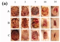 Materials Free Full Text Smart Dressings Based On Nanostructured Fibers Containing Natural Origin Antimicrobial Anti Inflammatory And Regenerative Compounds Html