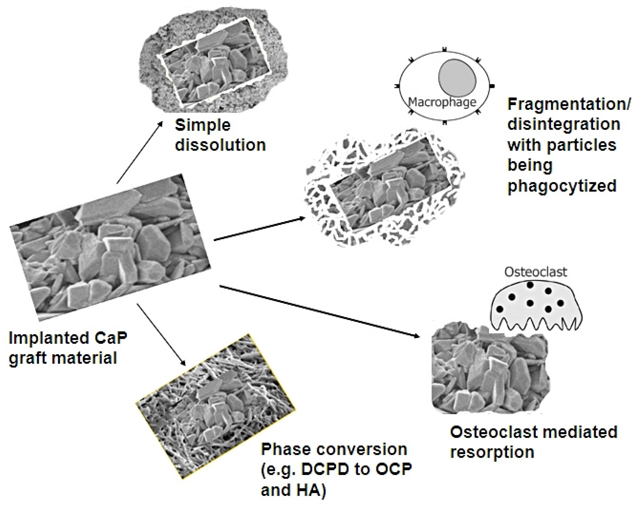 Materials | Free Full-Text | Mechanisms of in Vivo Degradation and  Resorption of Calcium Phosphate Based Biomaterials