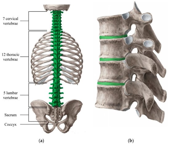 Materials | Free Full-Text | Materials for the Spine: Anatomy, Problems,  and Solutions
