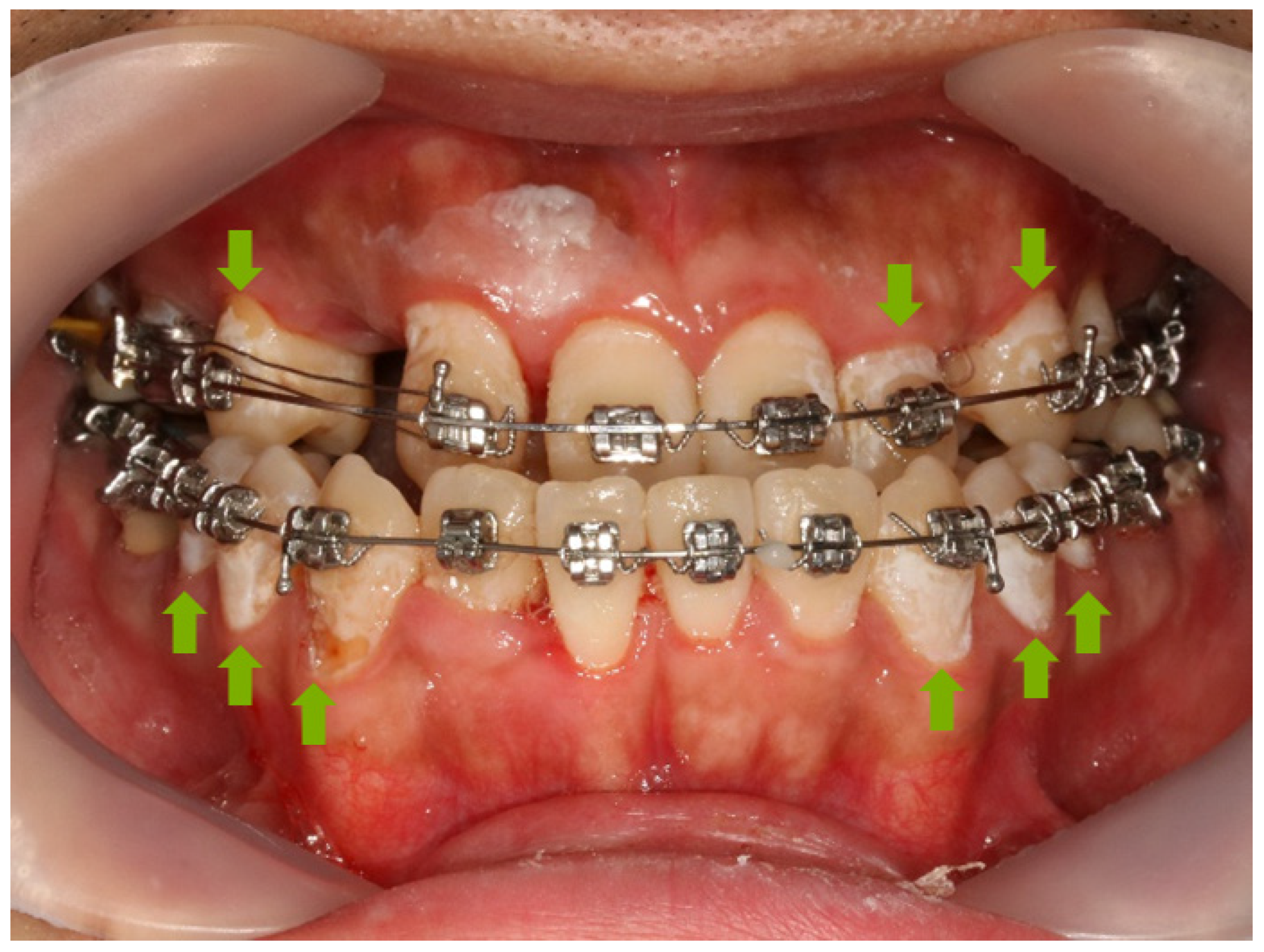Materials 12 01813 g001 Materials 12 01813 g001
