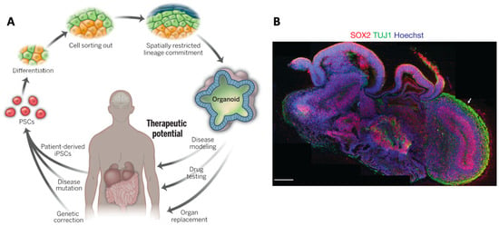 Fresh Brains Are Way Squishier Than You Thought, Smart News