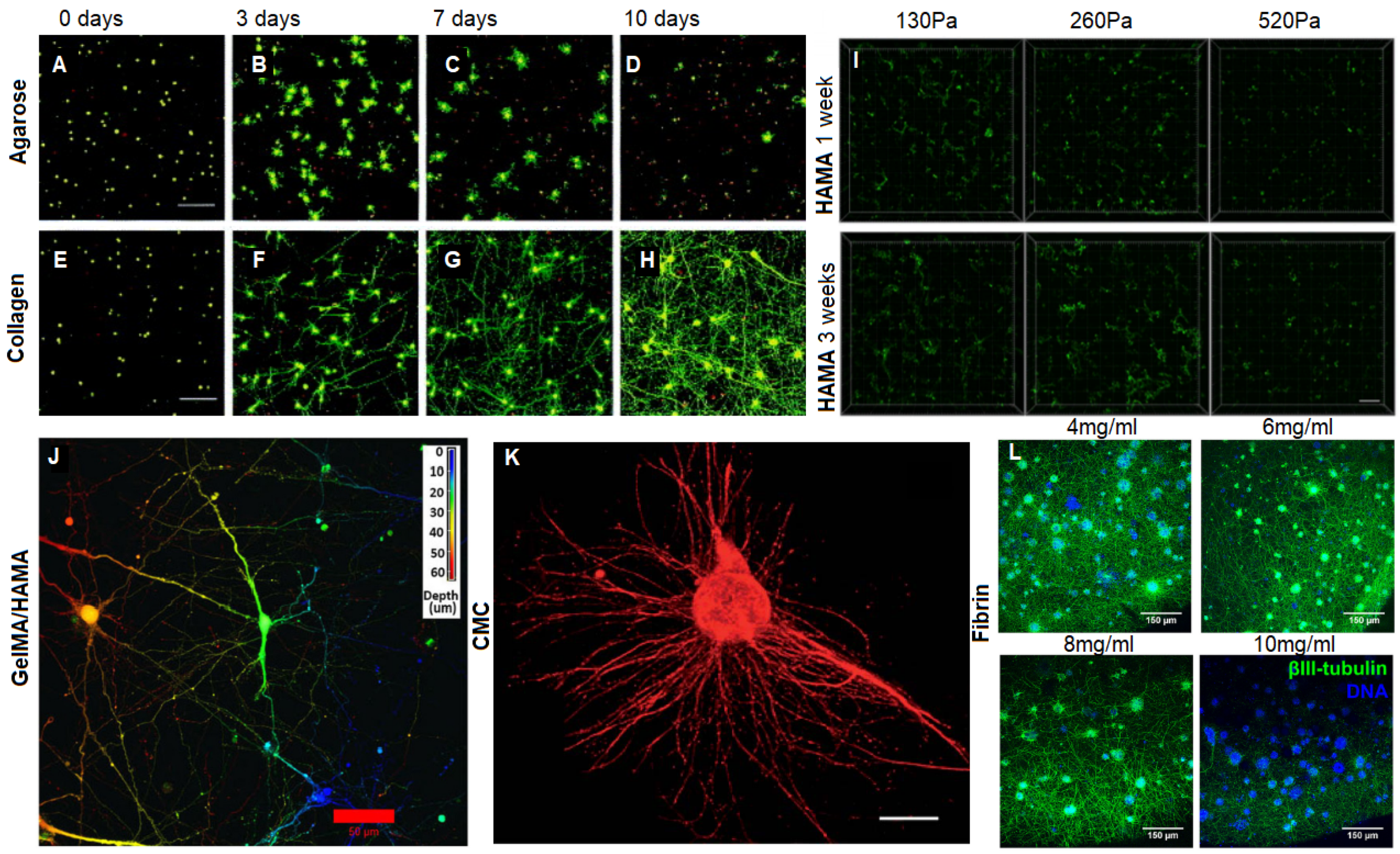 Materials Free Full Text Layer By Layer The Case For 3d Bioprinting Neurons To Create Patient Specific Epilepsy Models