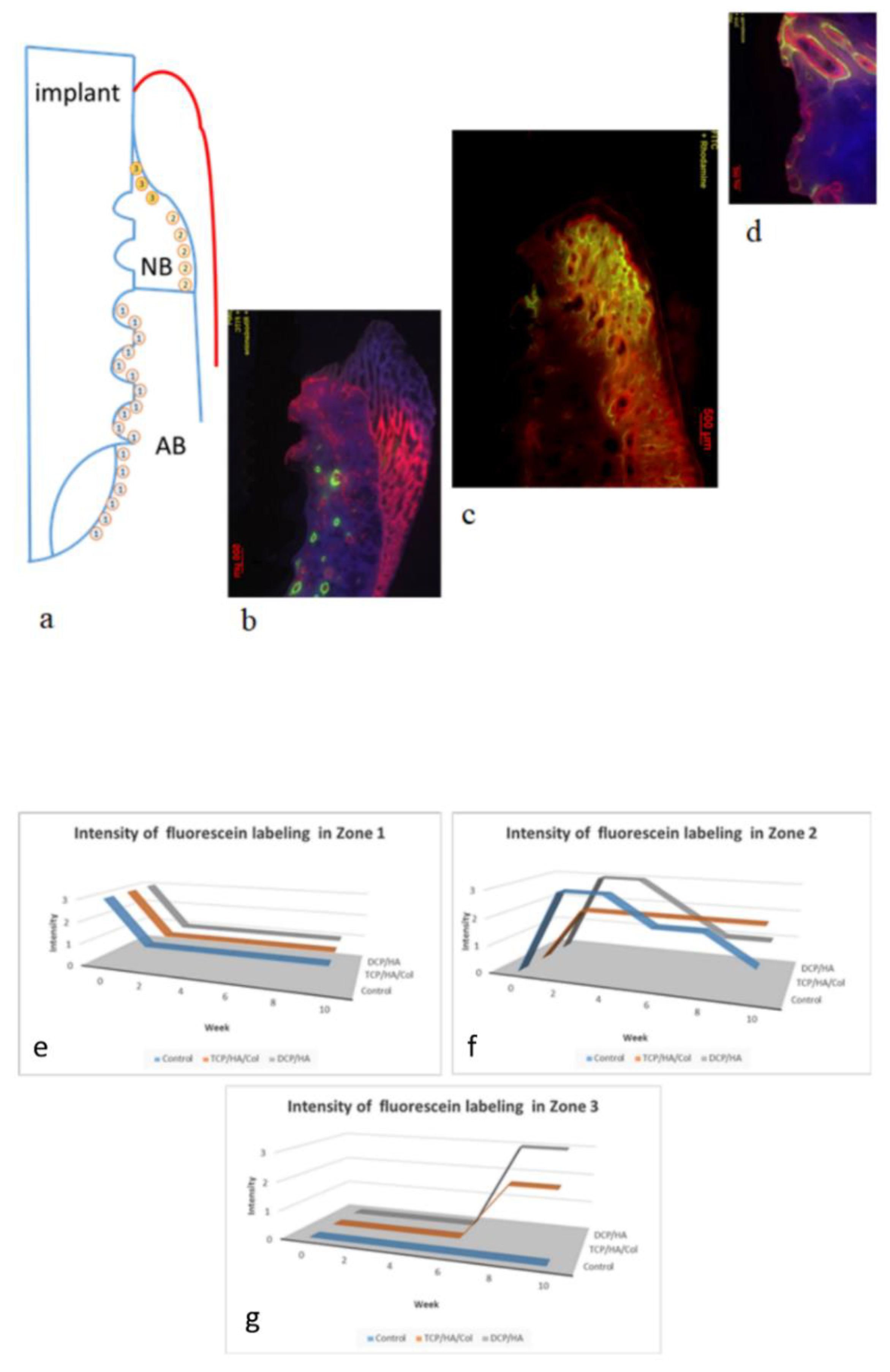 Materials Free Full Text Neutralized Dicalcium Phosphate And Hydroxyapatite Biphasic Bioceramics Promote Bone Regeneration In Critical Peri Implant Bone Defects Html