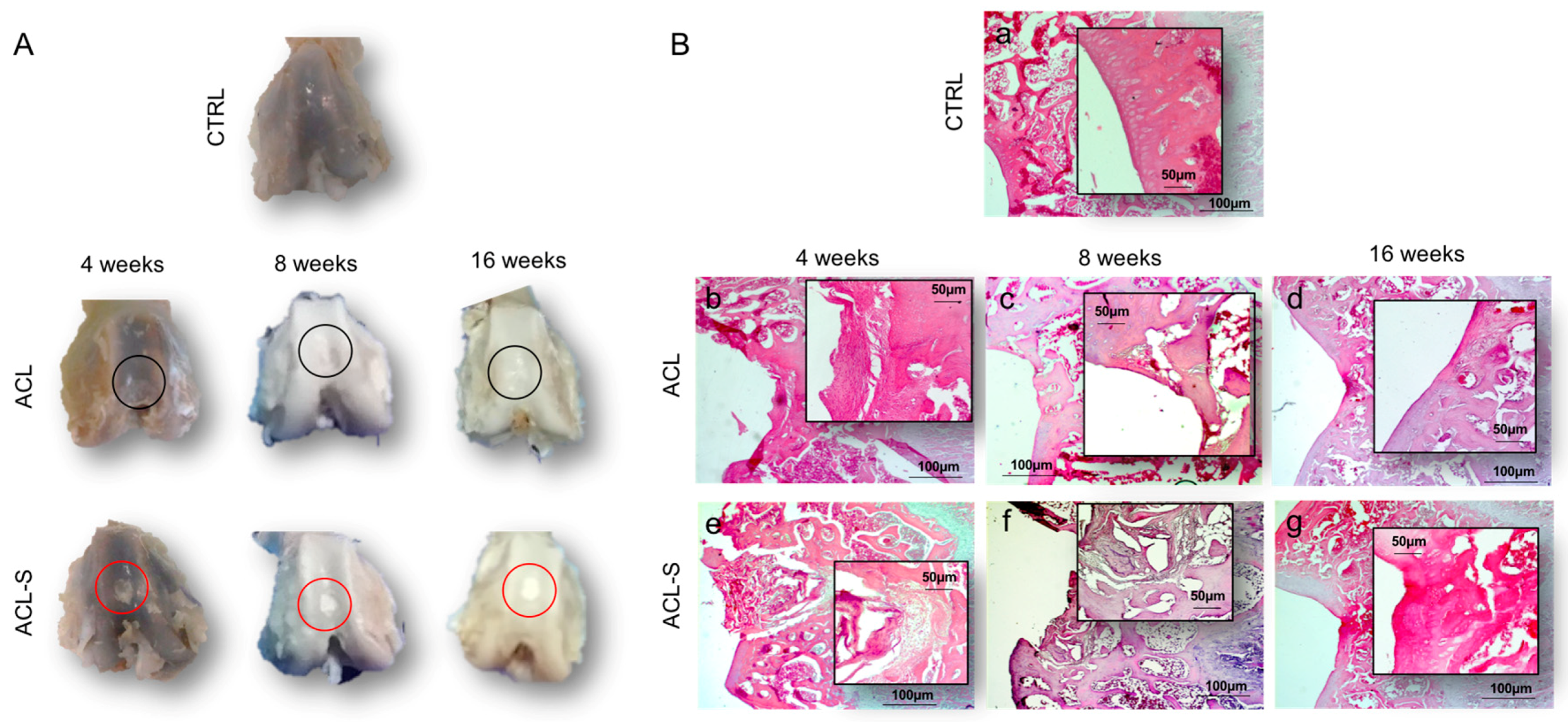 Materials Free Full Text Evaluation Of A Cell Free Collagen Type I Based Scaffold For Articular Cartilage Regeneration In An Orthotopic Rat Model Html