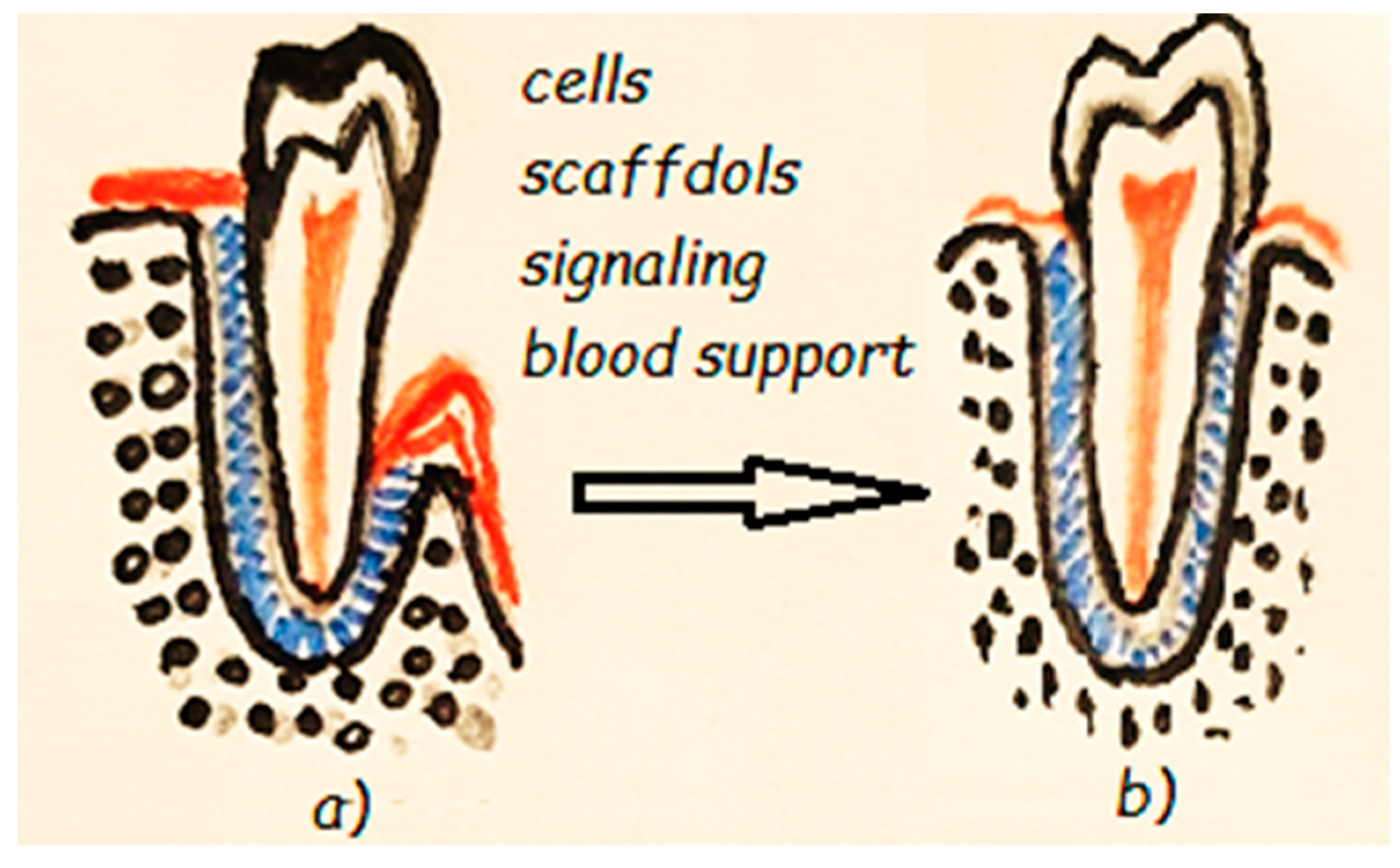 Materials Free Full Text Advanced Biomaterials And Techniques For Oral Tissue Engineering And Regeneration A Review Html