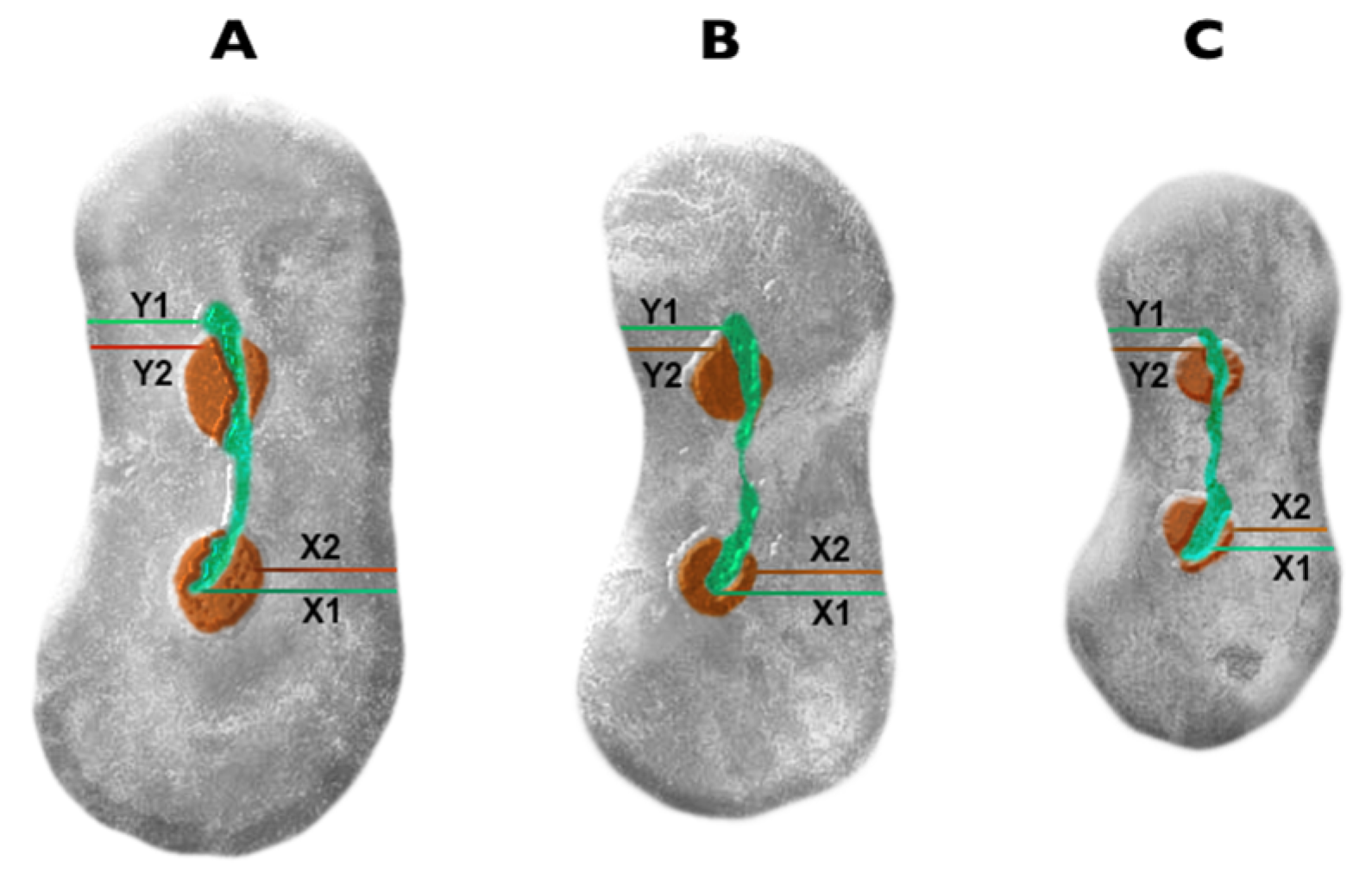 3D reconstructions showing microcracks in the mesial roots of