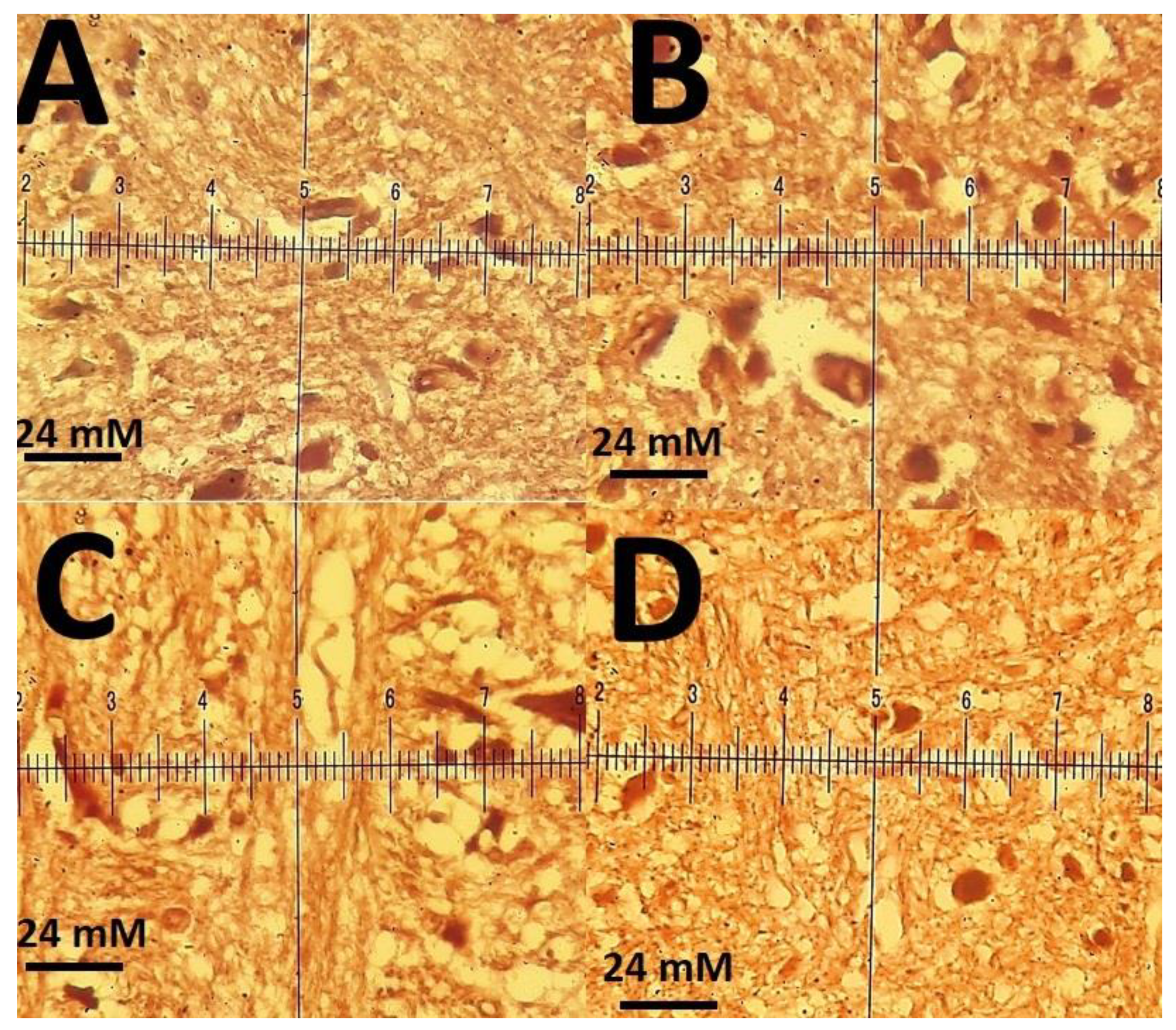 Materials 14 00825 g014
