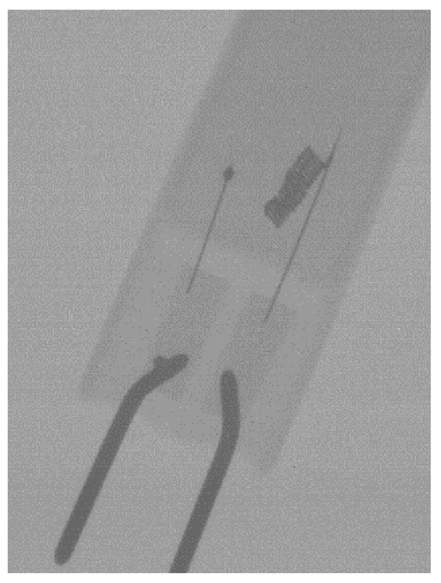 Materials 14 00888 g008