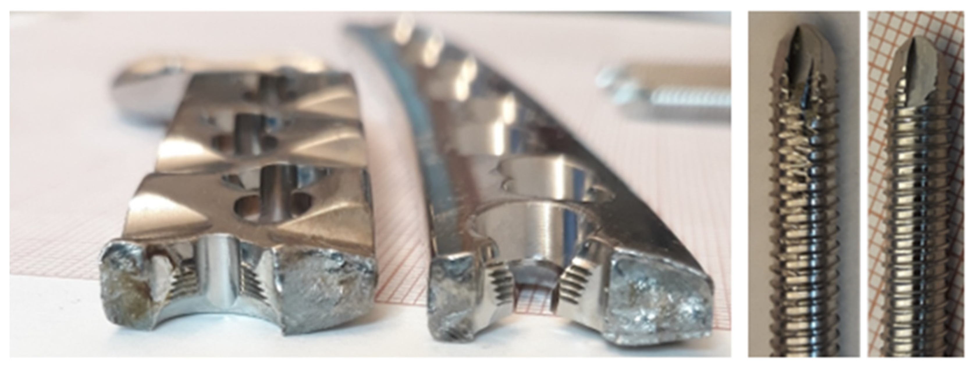 Spinal Compression Fractures: A Comprehensive Overview - Orthopedic  Implants & Instruments Manufacturer/Suppliers- Uteshiya