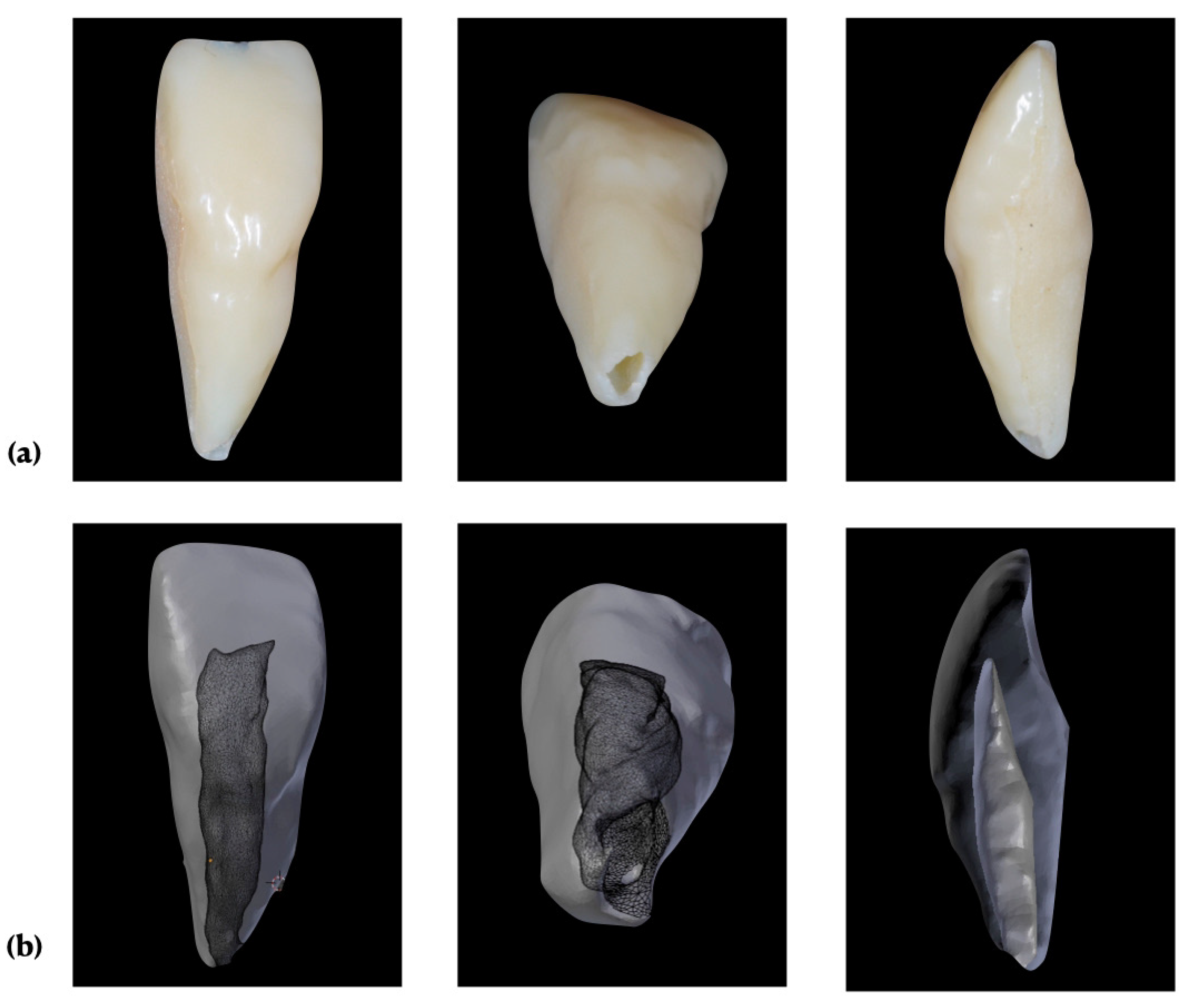 Materials | Free Full-Text | Apical Pressure Generated Using Conventional  Syringe Irrigation in Immature Teeth—An In Vitro Study