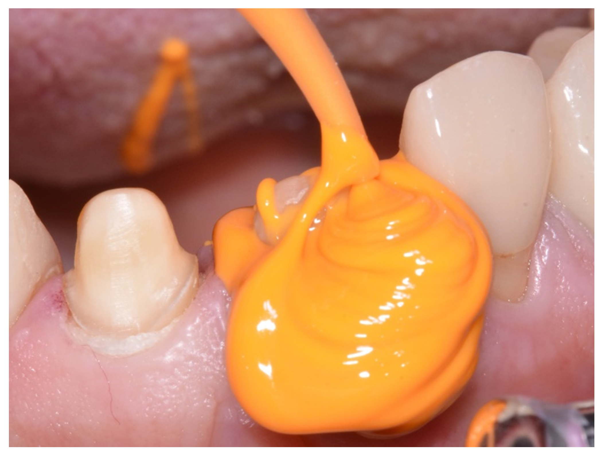 Materials 14 02994 g002 Materials 14 02994 g002