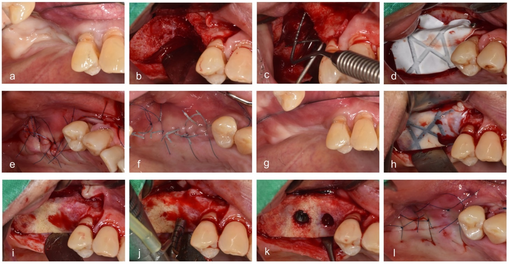 Materials 14 03828 g002