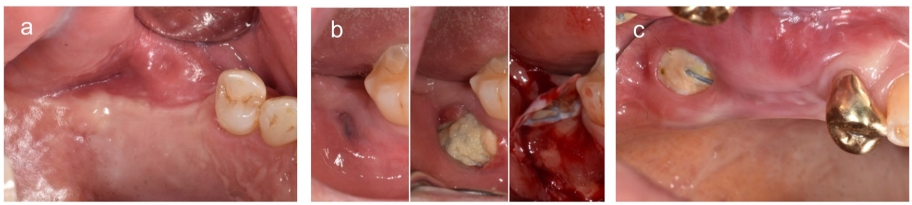 Materials 14 03828 g003