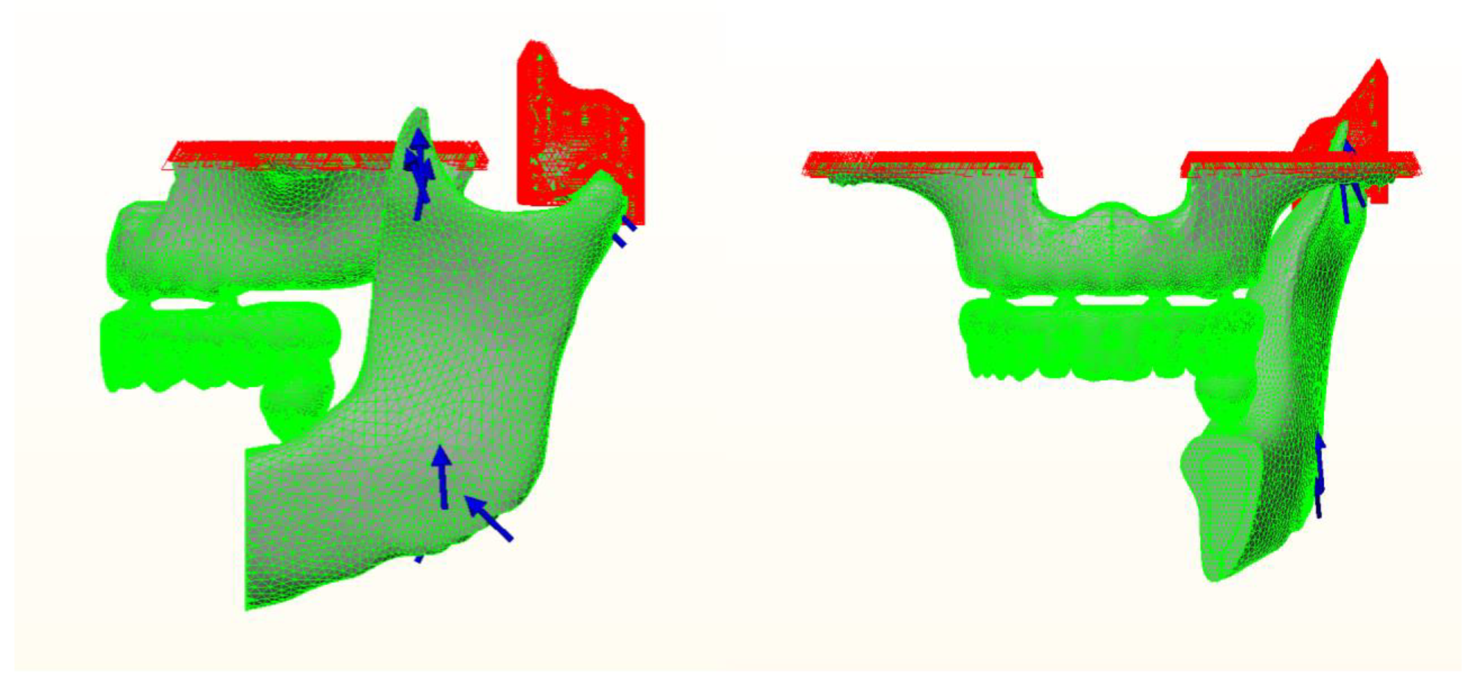 Materials 14 04308 g003