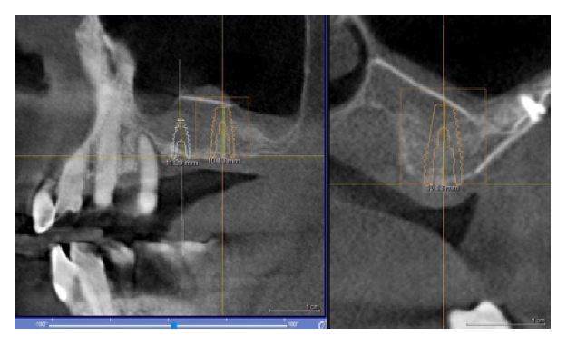 Materials 14 06642 g004