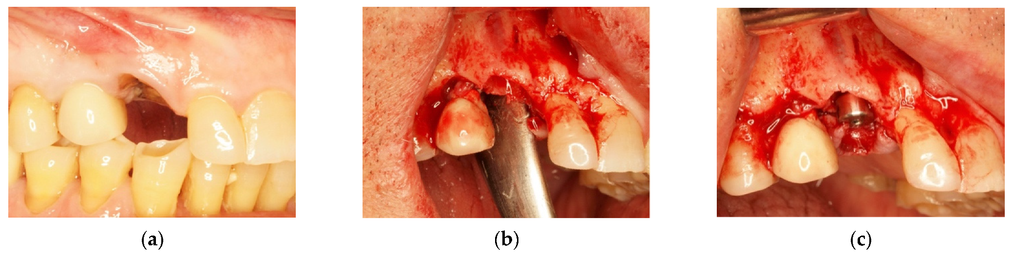 Materials 14 06642 g006