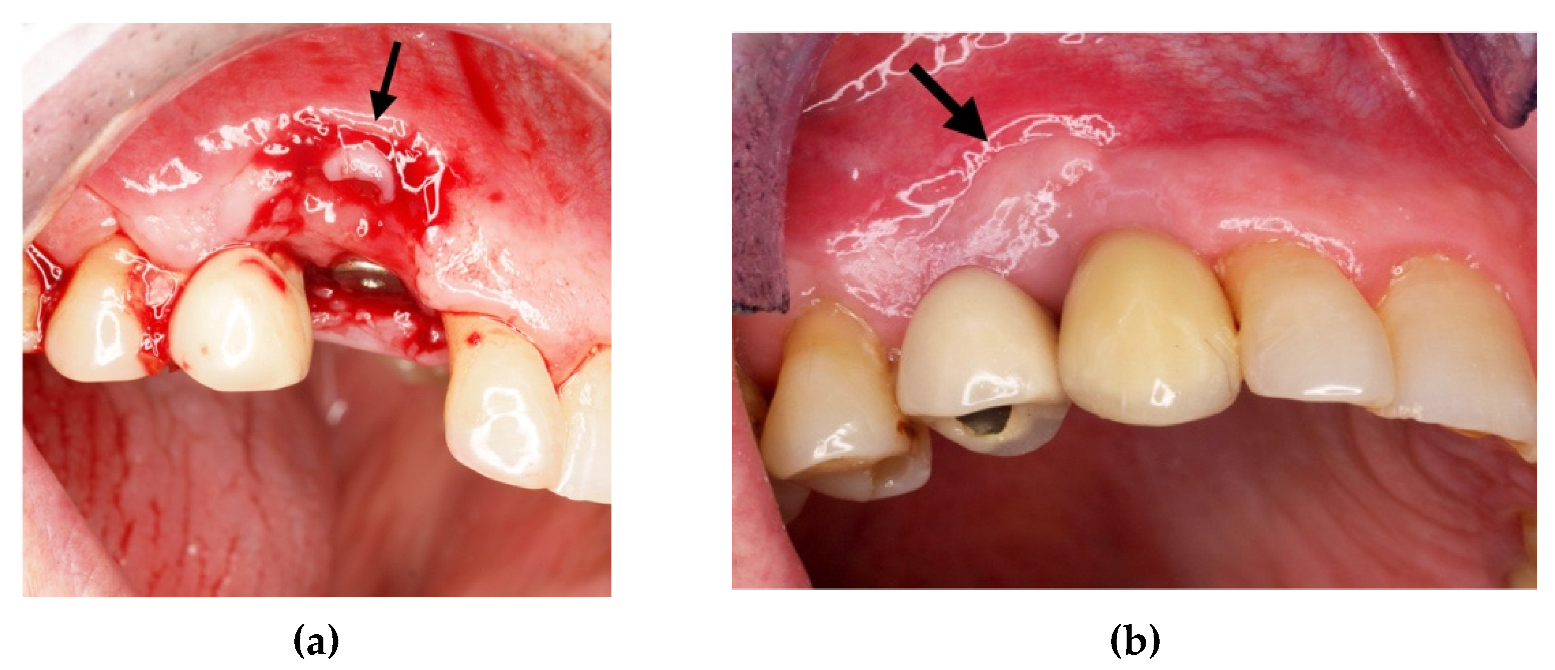 Materials 14 06642 g009