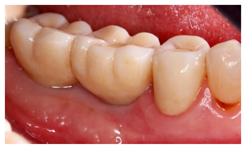 Materials 14 06642 g012