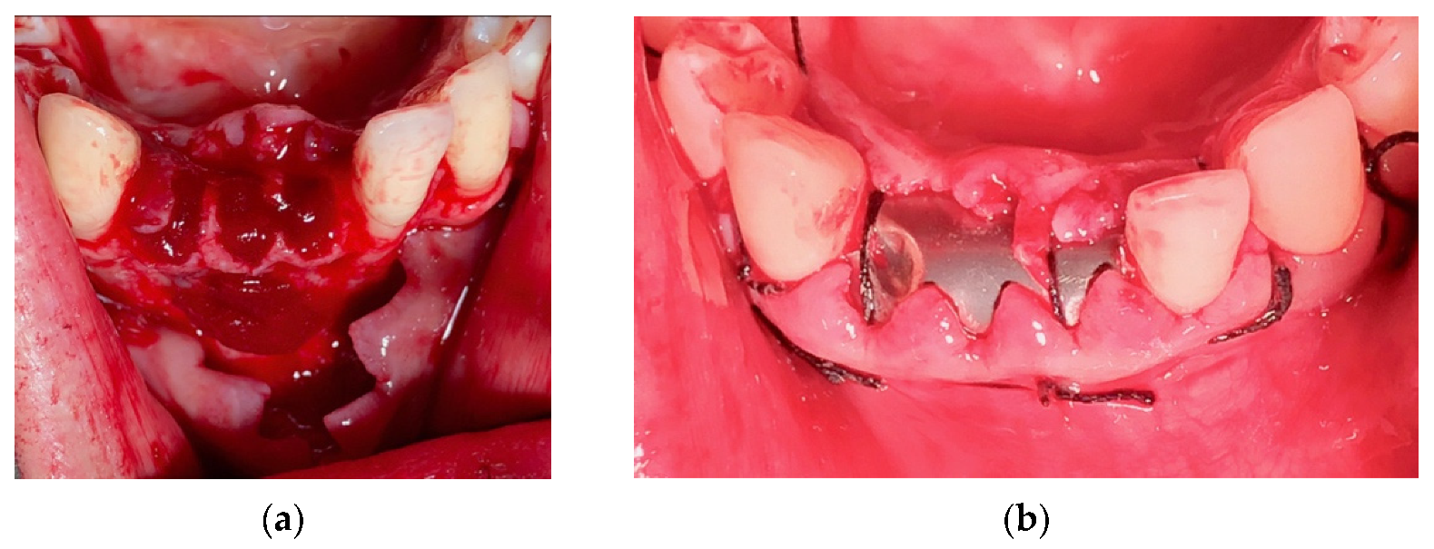 Materials 14 06642 g014