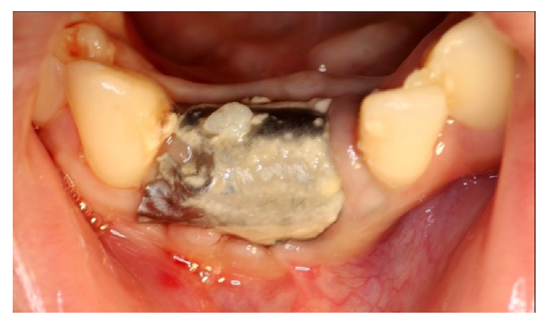 Materials 14 06642 g015