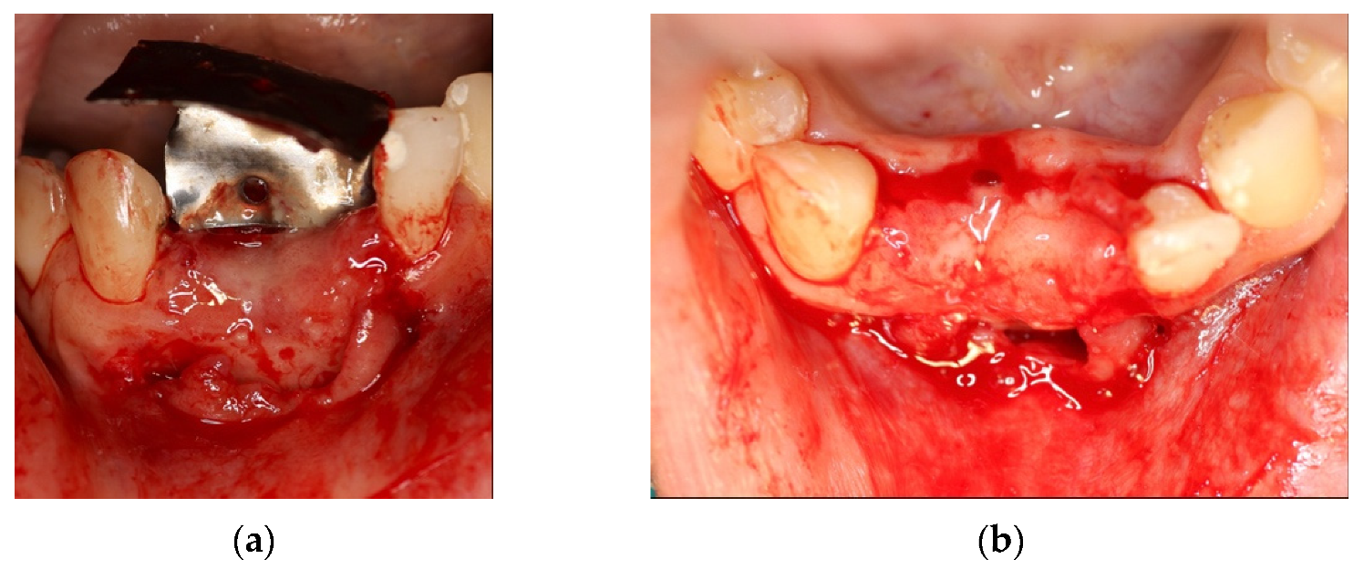 Materials 14 06642 g016