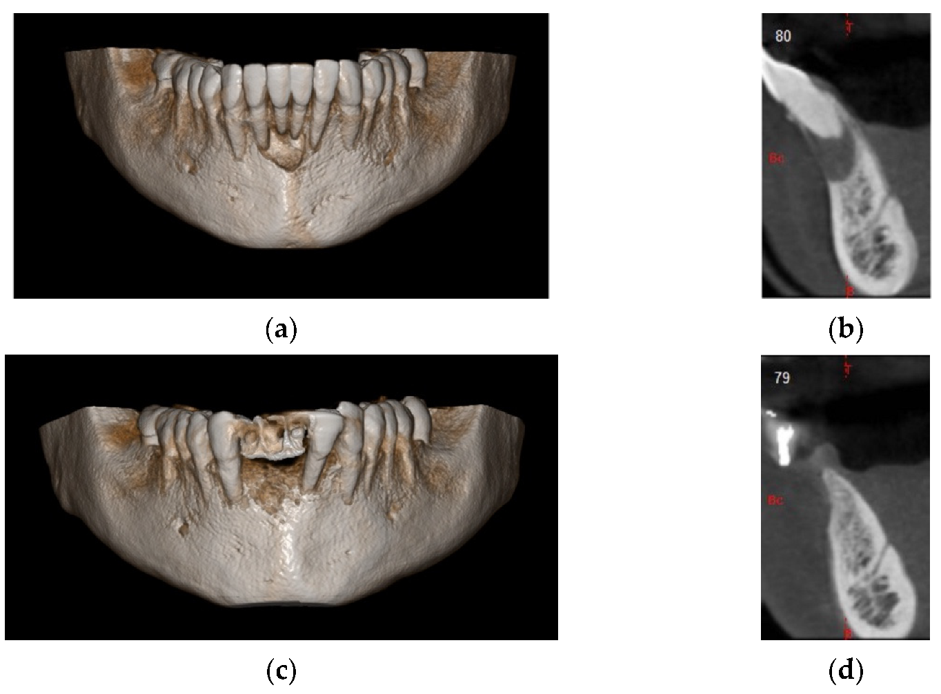 Materials 14 06642 g017