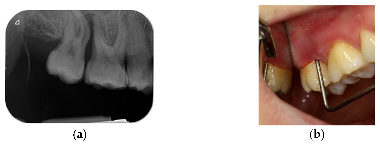 Materials 14 06642 g019