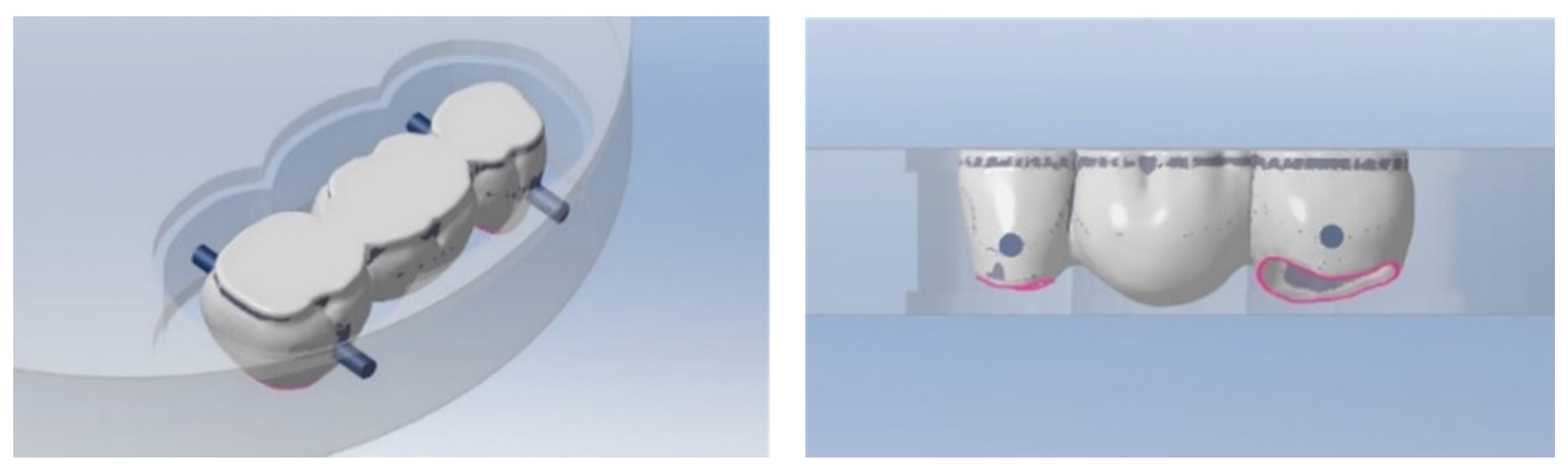 Materials 14 06887 g002