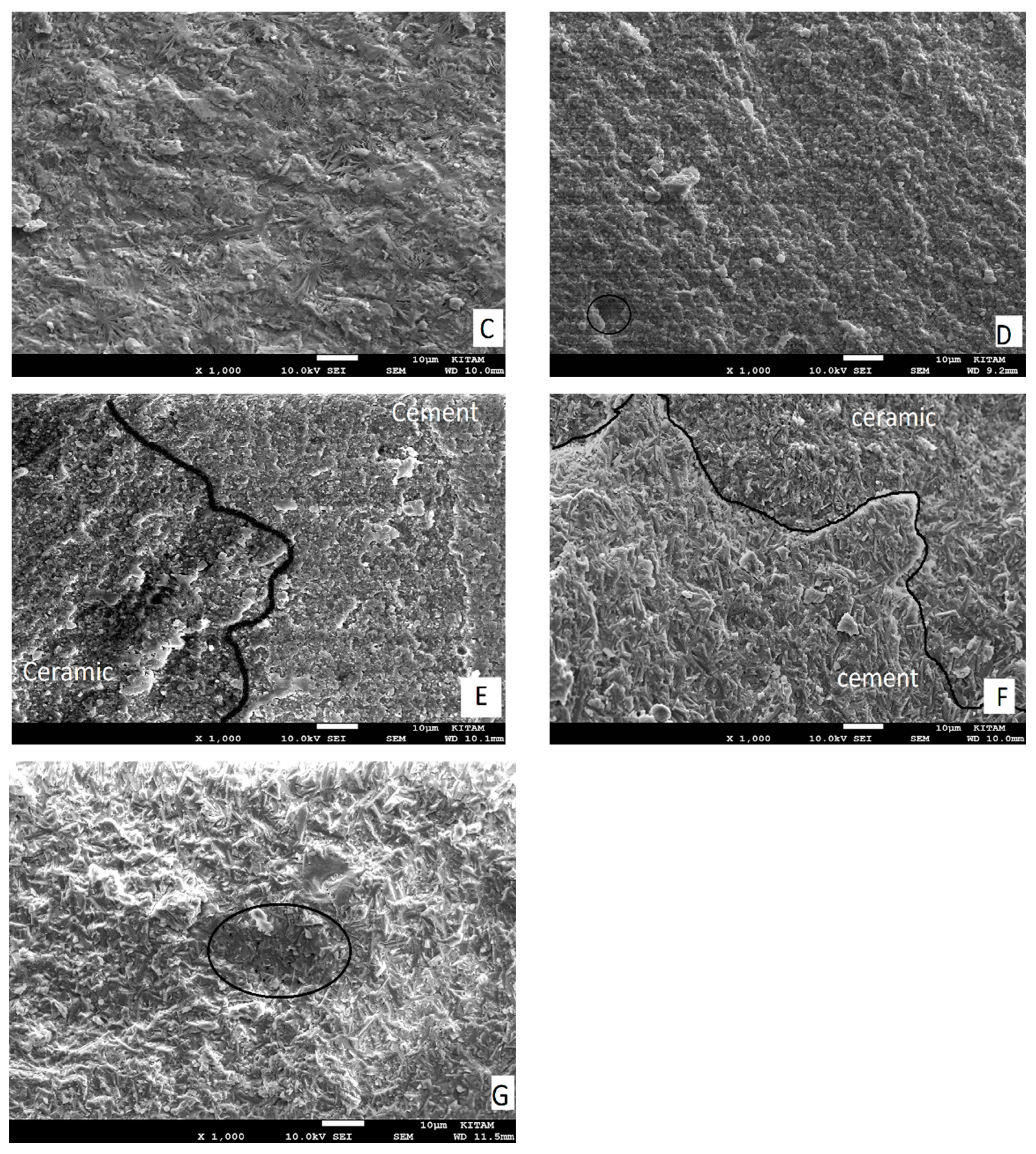 Materials | Free Full-Text | Comparison of Silane Heat Treatment by Laser  and Various Surface Treatments on Microtensile Bond Strength of Composite  Resin/Lithium Disilicate | HTML