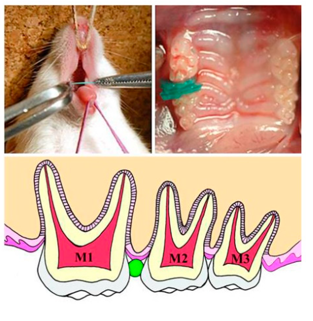 periodontal membrane