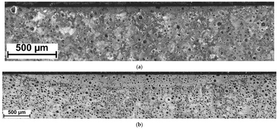 High-Power Diode Laser Surface Transformation Hardening Of Ferrous Alloys