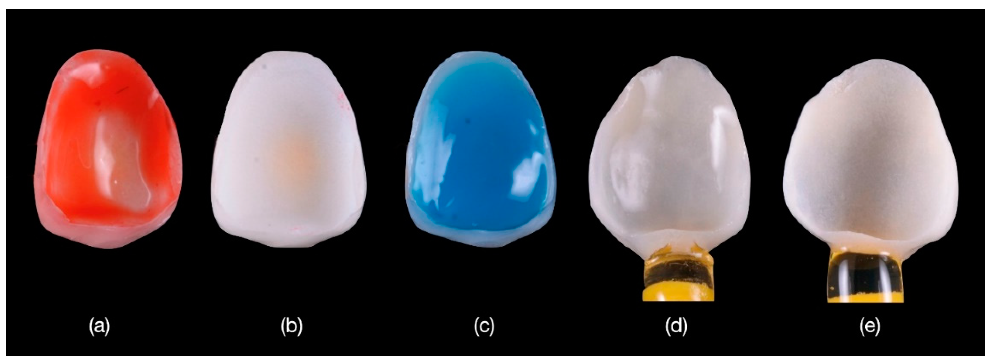 Materials | Free Full-Text | Retrospective Long-Term Clinical Outcome of Feldspathic  Ceramic Veneers | HTML