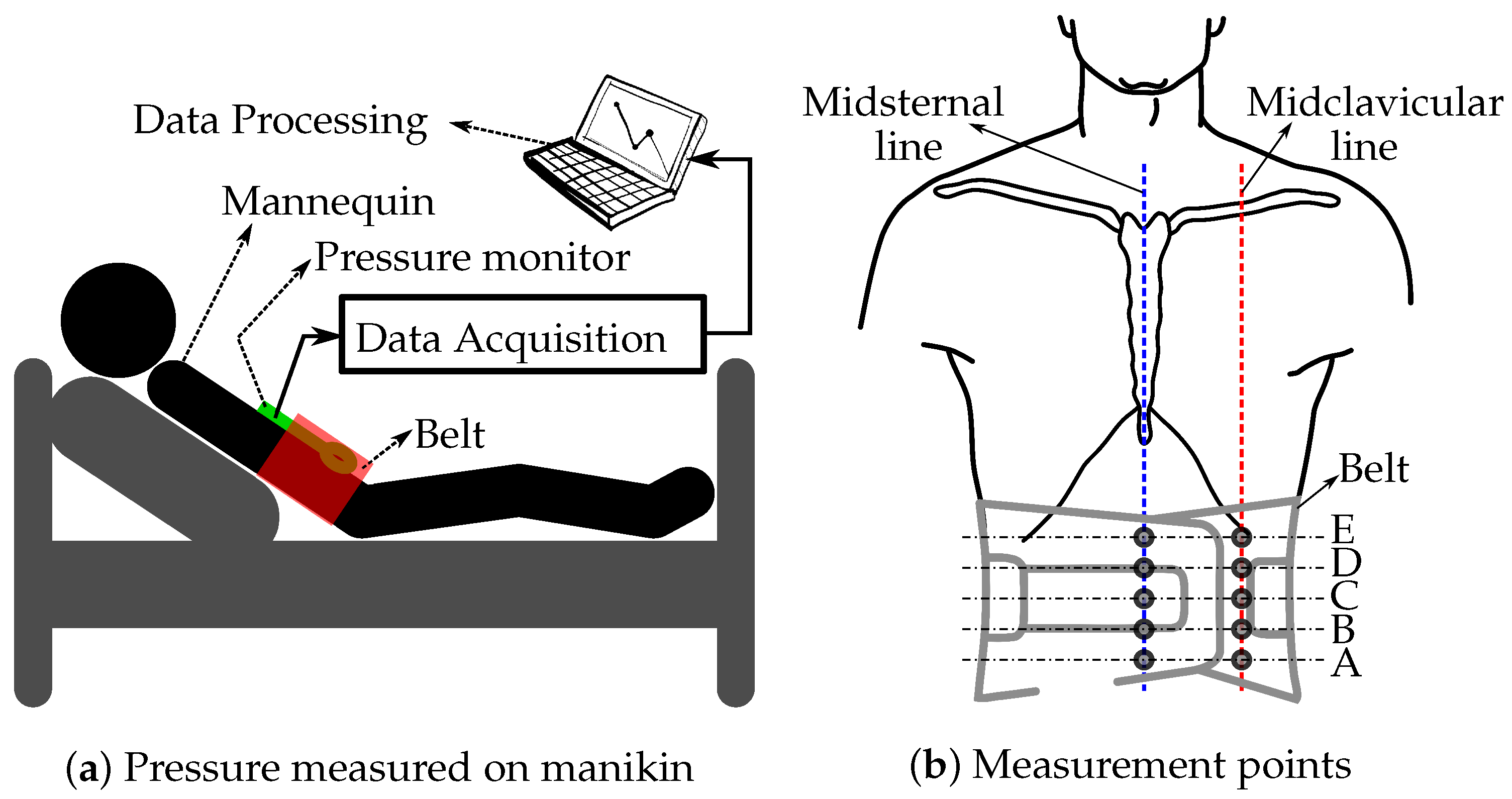 Materials | Free Full-Text | Assessment of Abdominal Constrictor&rsquo;s  Forces for Informing Computational Models of Orthostatic Hypotension