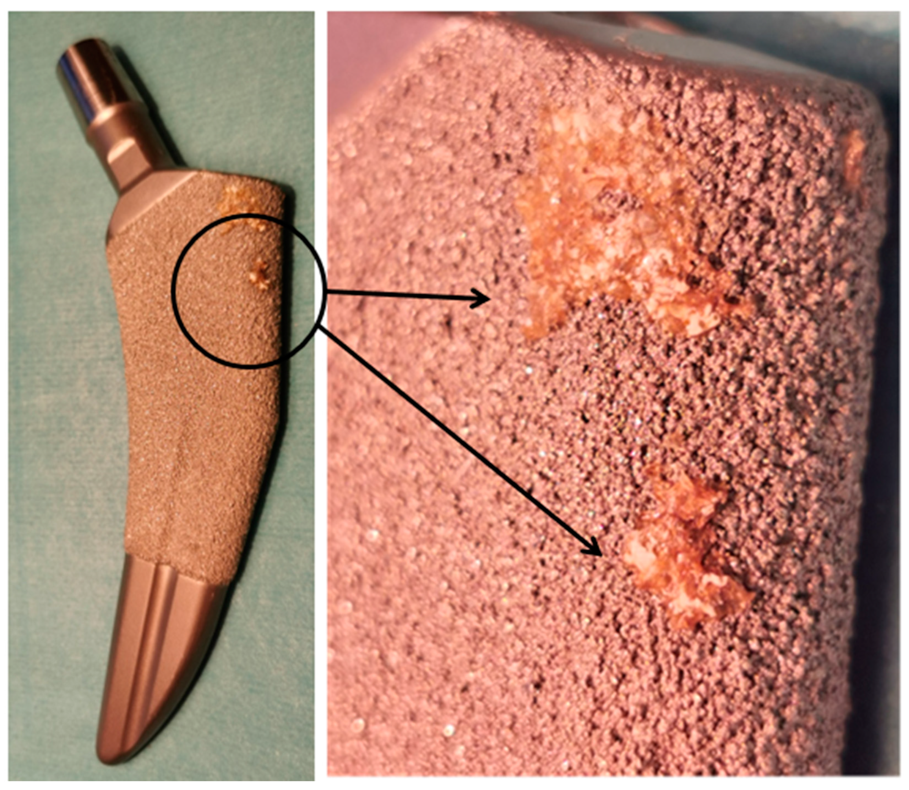 Materials 15 03622 g004