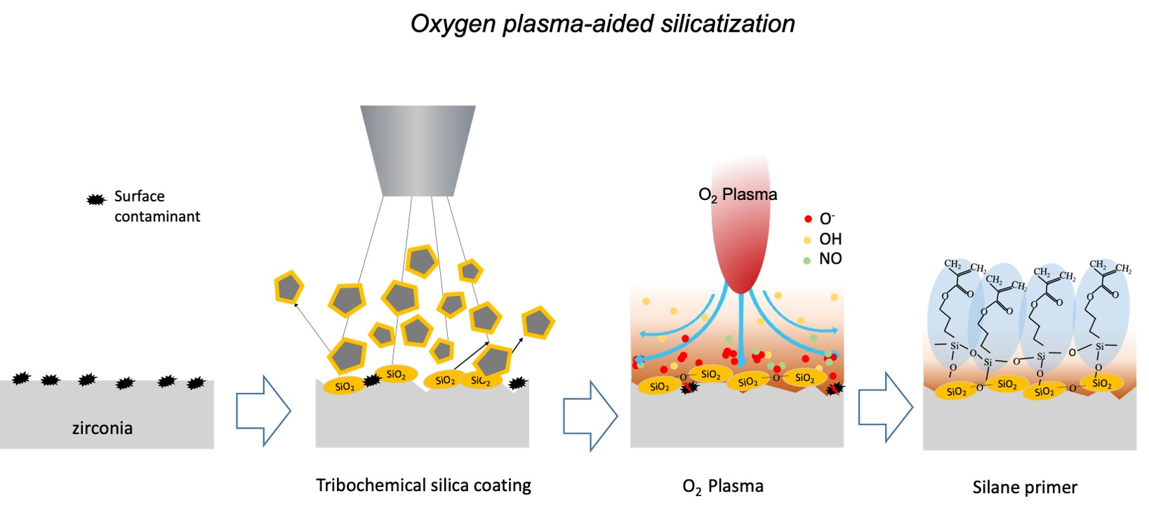 Materials | Free Full-Text | Enhancing Resin Cement Adhesion to ...