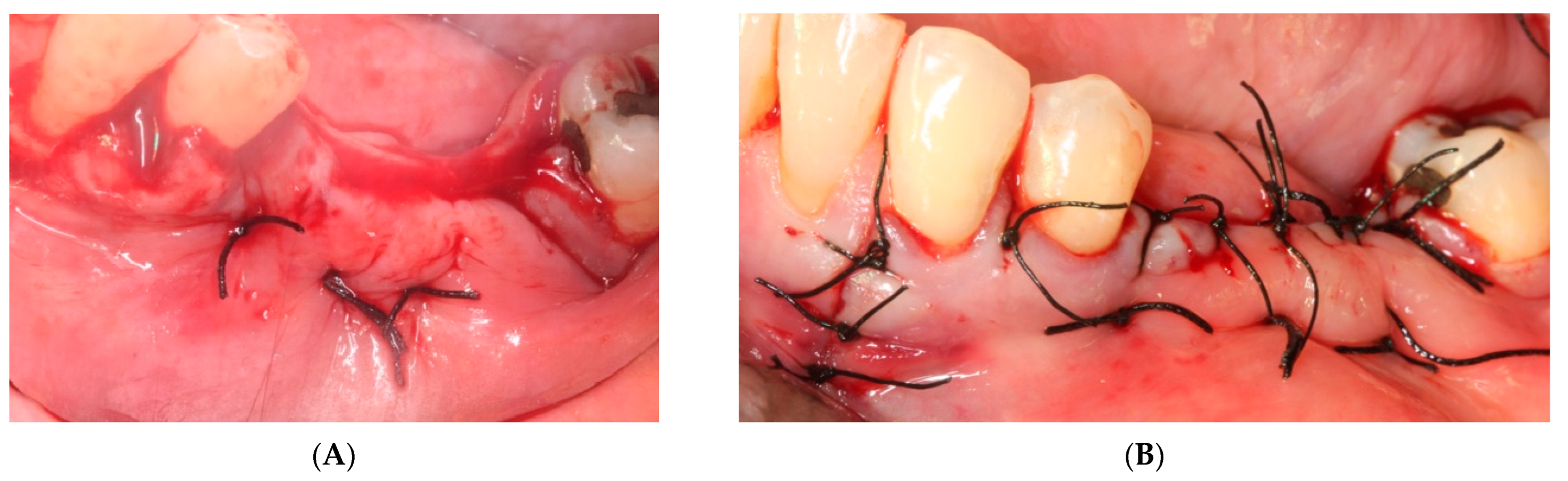 Materials 15 06271 g006