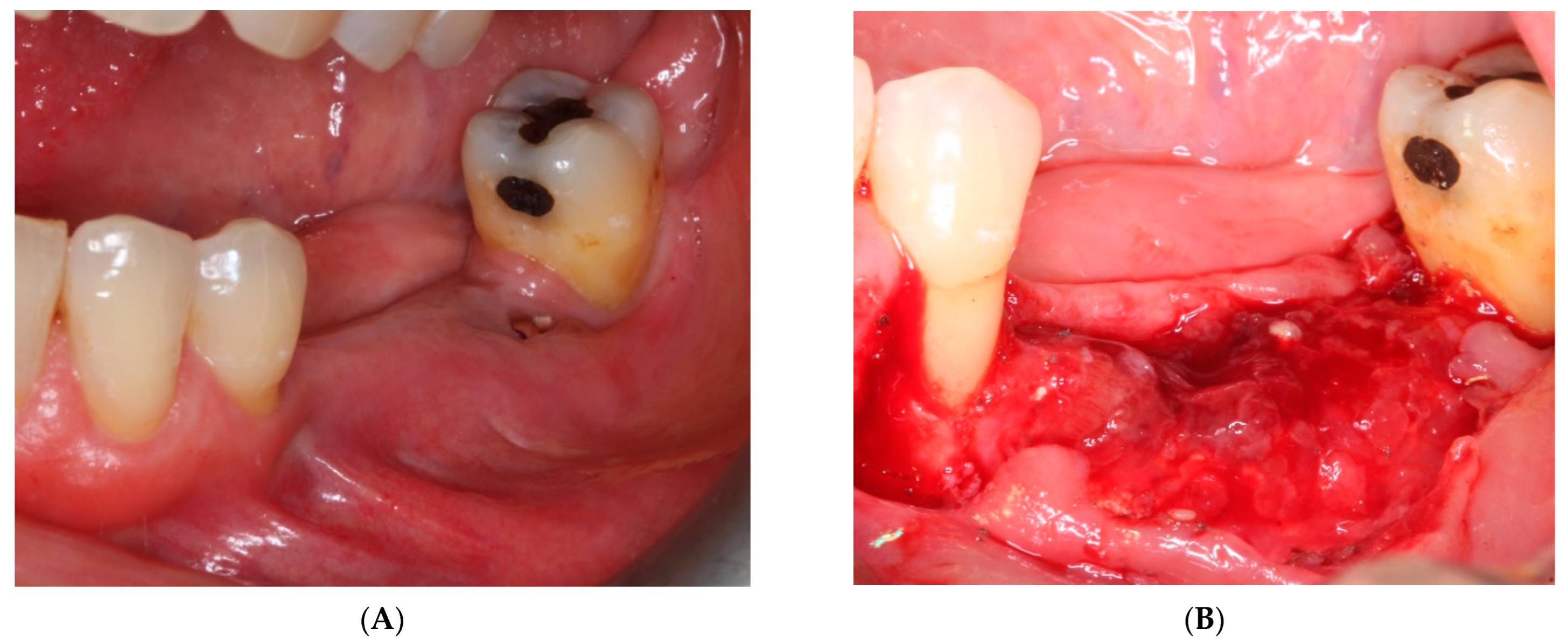 Materials 15 06271 g009