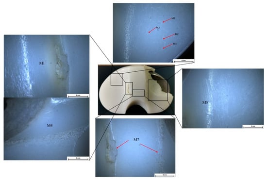 Comparative Analysis of Contemporary Fixed Tibial Inserts: A