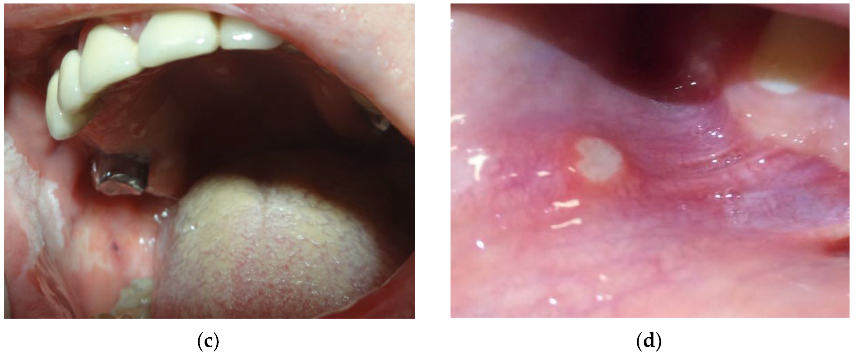 Materials 15 07476 g003b