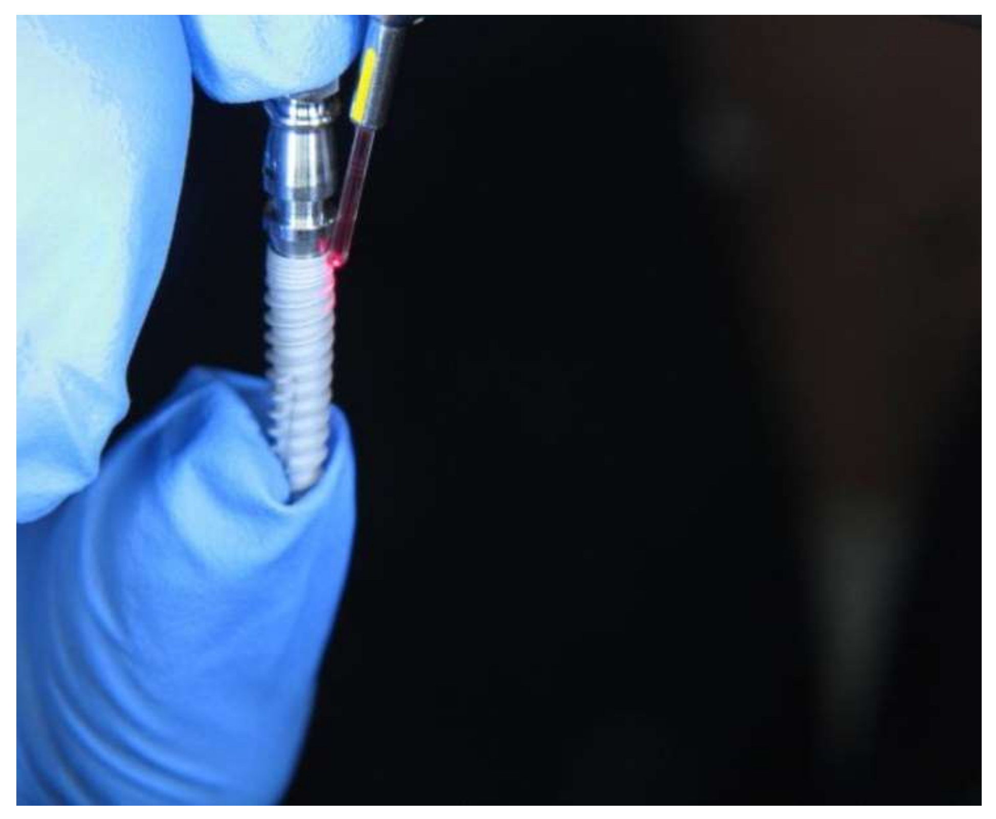 Materials 15 07889 g003 Materials 15 07889 g003