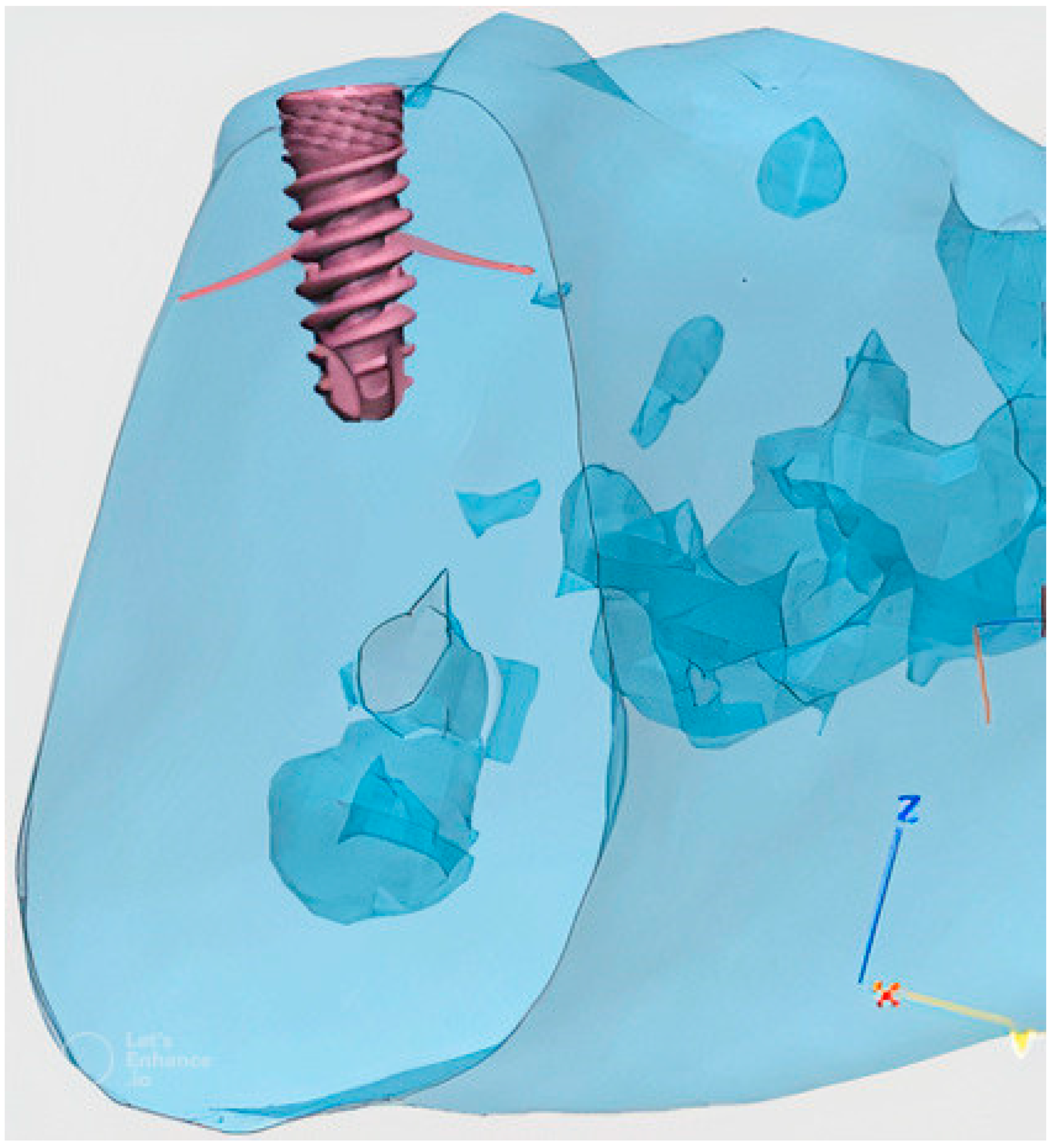 Materials 16 02228 g007 Materials 16 02228 g007