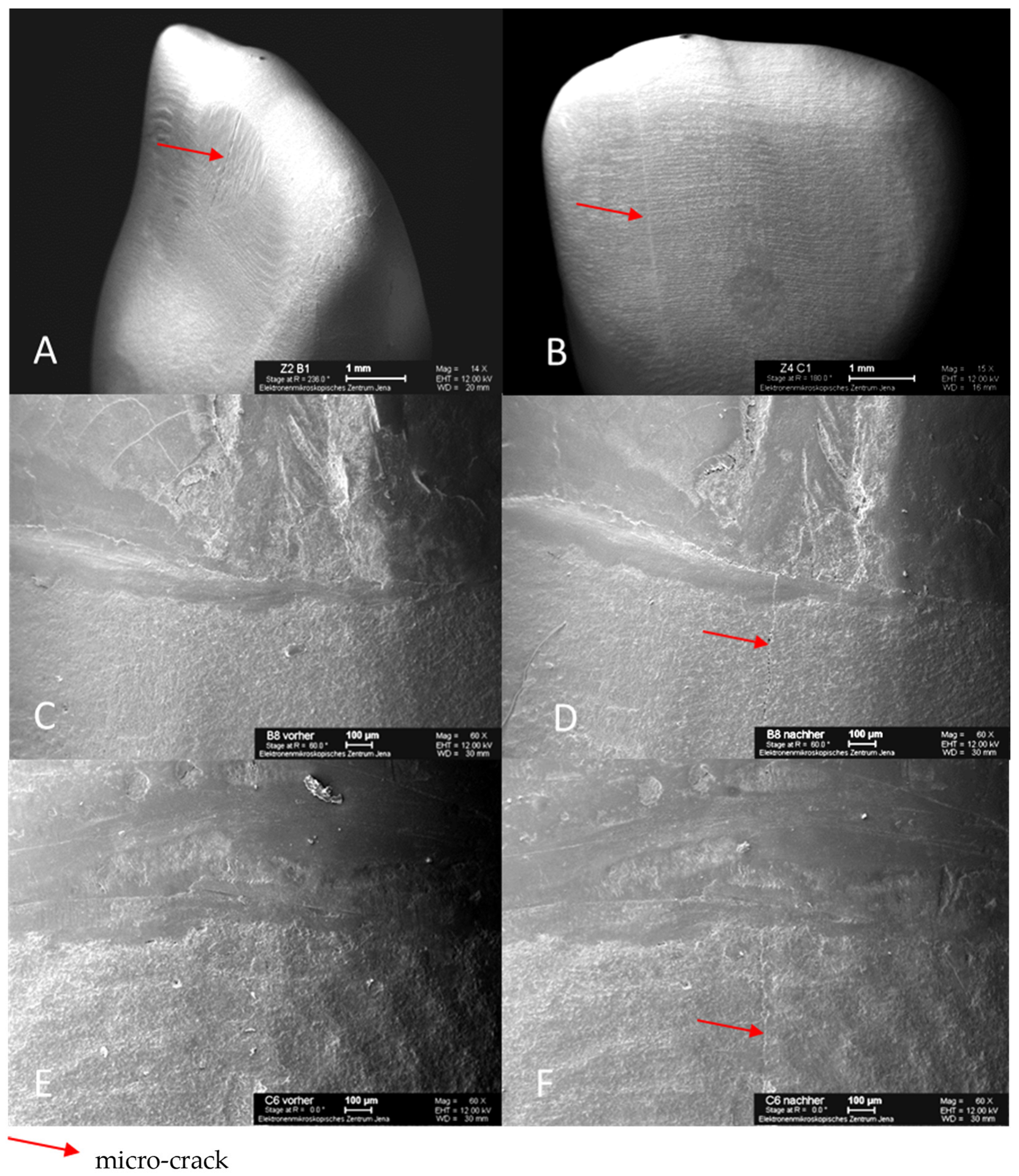Materials 16 03985 g008 Materials 16 03985 g008