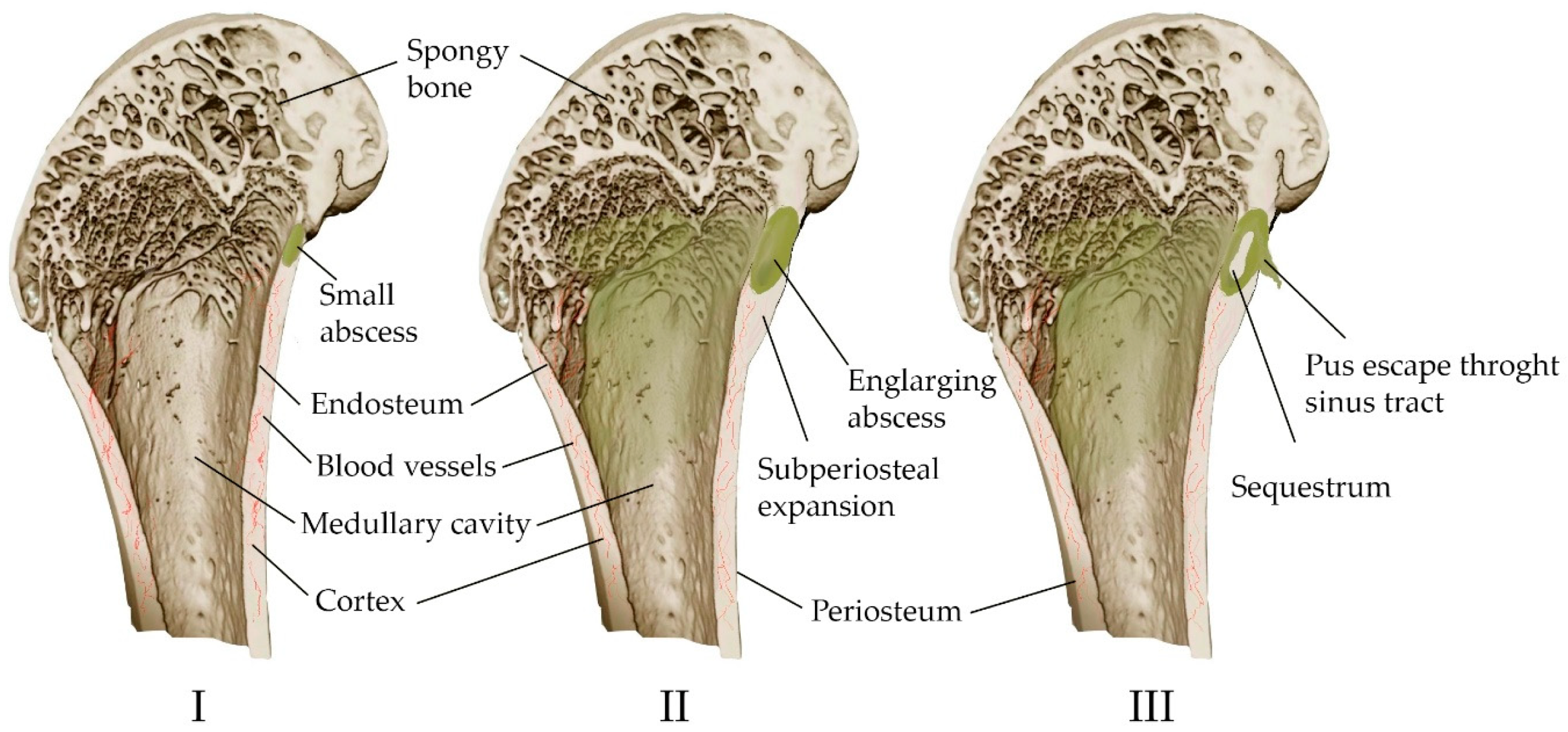 Materials 16 04017 g002