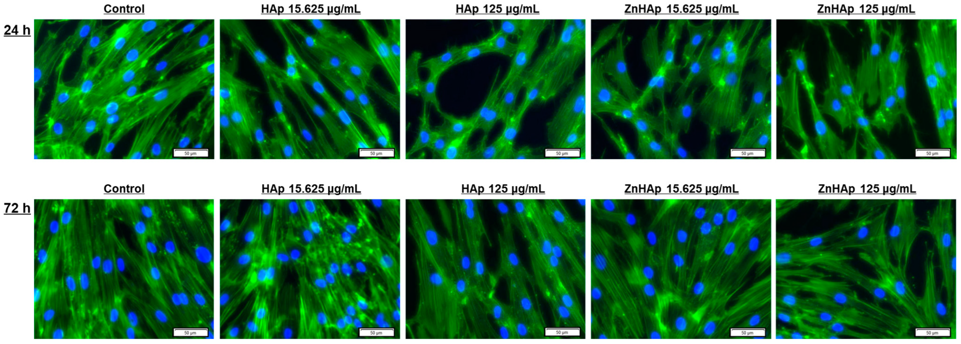 Materials 16 04145 g007 Materials 16 04145 g007