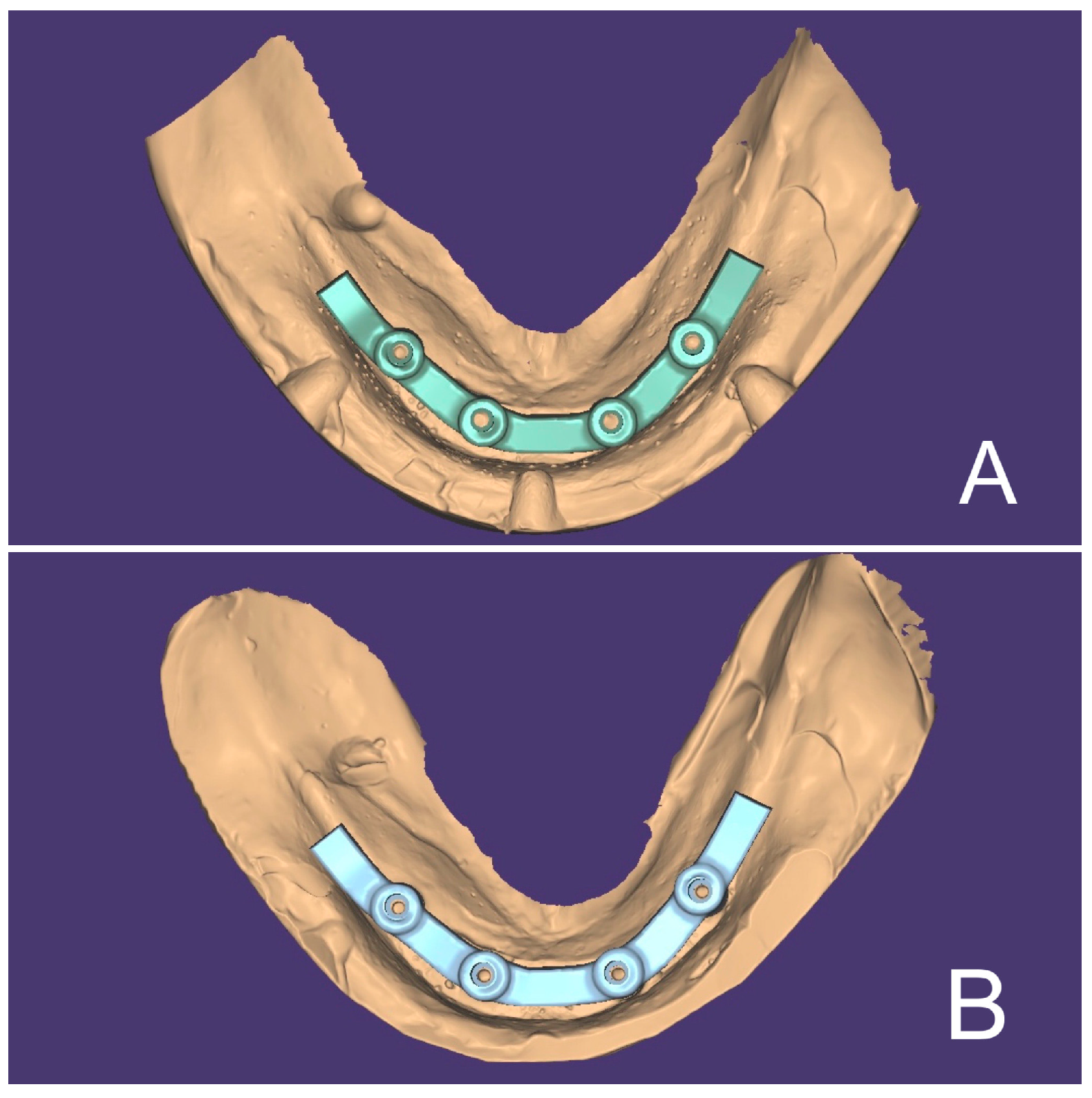 Materials 16 04176 g004